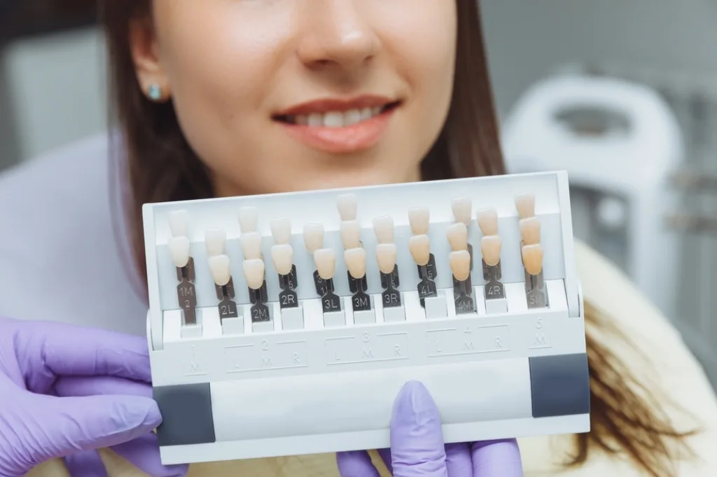 GN Dental Yuba City | Composite Veneers