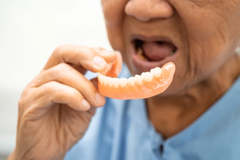 GN Dental Yuba City | Full & Partial Dentures