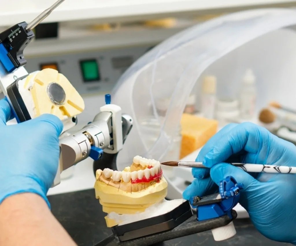 GN Dental Yuba City | Dental Crowns & Bridges