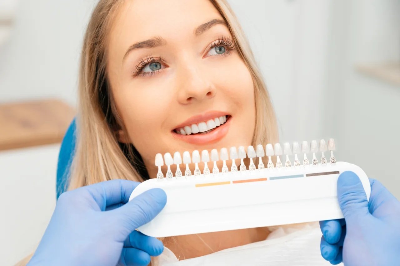 GN Dental Yuba City | Veneers